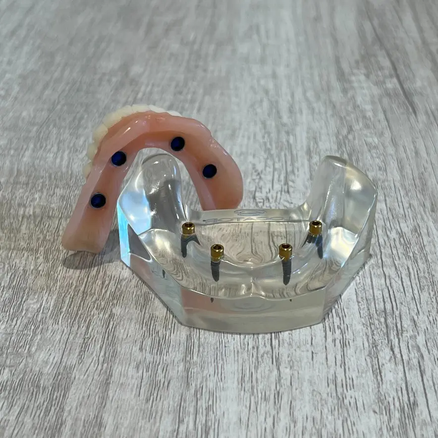 snap-in implant dentures Conroe, TX
