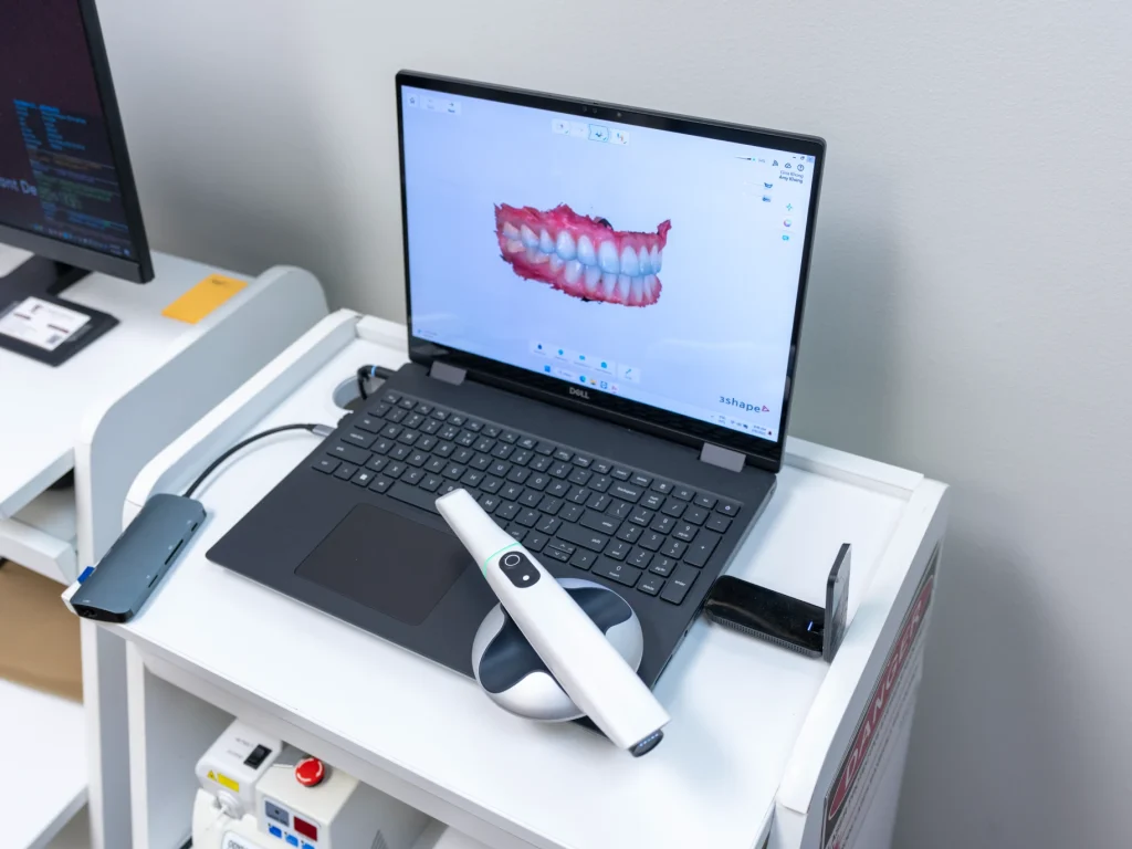 3D intra oral scanner technology at Conroe Dental Associates